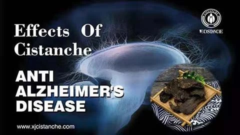 Anti-Alzheimer