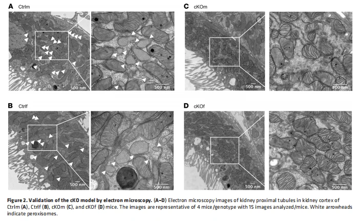 Figure 2. Validation of the cKO model by electron microscopy. (A–D) Electron microscopy images of kidney proximal tubules in kidney cortex of  Ctrlm (A), Ctrlf (B), cKOm (C), and cKOf (D) mice. The images are representative of 4 mice/genotype with 15 images analyzed/mice. White arrowheads  indicate peroxisomes.